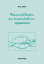 Phakoemulsifikation und Intraokularlinsenimplantation, m. CD-ROM