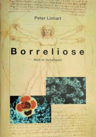 Borreliose