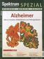 Alzheimer