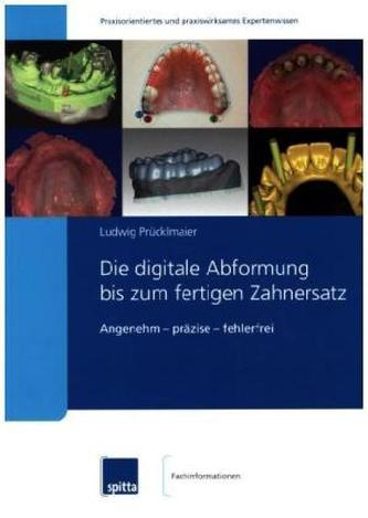 Die digitale Abformung bis zum fertigen Zahnersatz