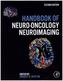 Handbook of Neuro-Oncology Neuroimaging