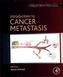 Introduction to Cancer Metastasis