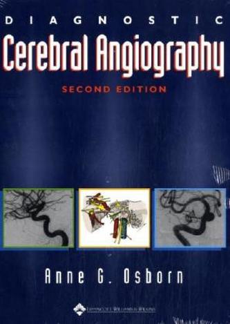 Diagnostic Cerebral Angiography