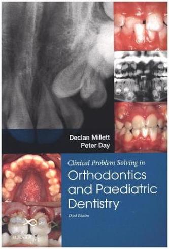 Clinical Problem Solving in Dentistry: Orthodontics and Paediatric Dentistry