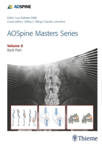 AOSpine Masters Series - Back Pain
