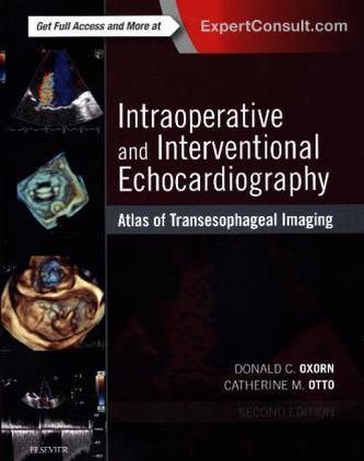 Intraoperative and Interventional Echocardiography