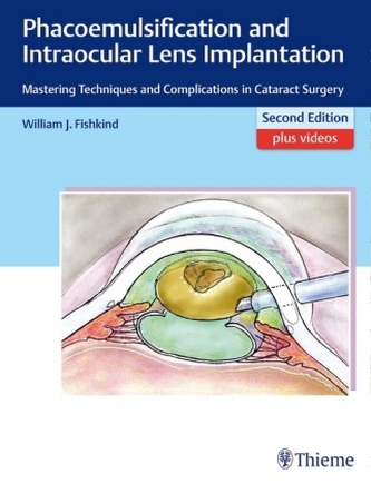 Phacoemulsification and Intraocular Lens Implantation