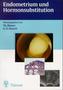 Endometrium und Hormonsubstitution