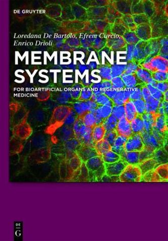 Membrane Systems Membrane Systems