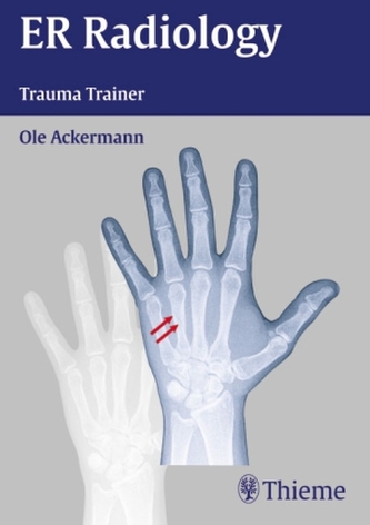 ER Radiology Trauma Trainer, 1 DVD-ROM