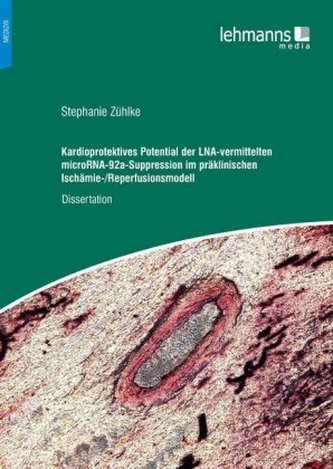 Kardioprotektives Potential der LNA-vermittelten microRNA-92a-Suppression im präklinischen Ischämie-/Reperfusionsmodell