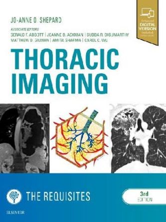 Thoracic Imaging