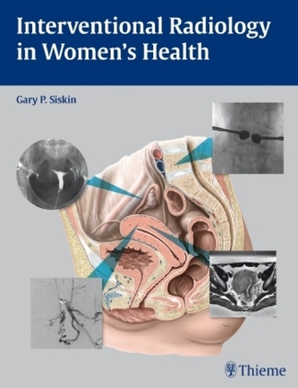 Interventional Radiology in Women's Health