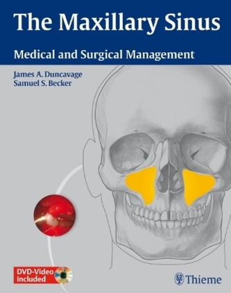 The Maxillary Sinus, w. 2 DVDs