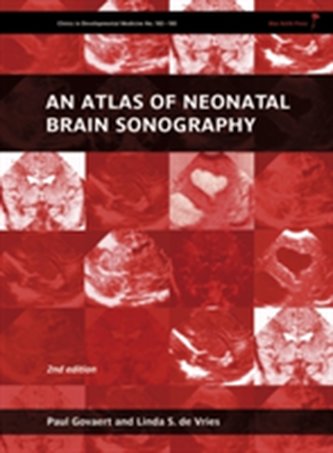 An Atlas of Neonatal Brain Sonography