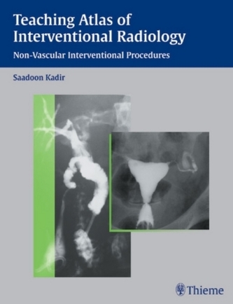 Teaching Atlas of Interventional Radiology