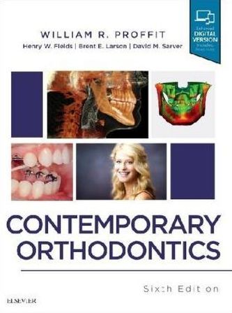 Contemporary Orthodontics