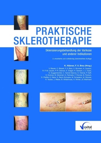 Praktische Sklerotherapie