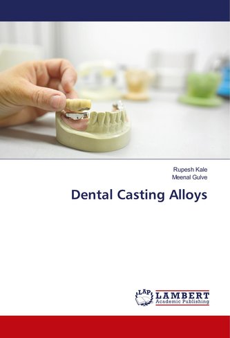 Dental Casting Alloys