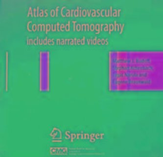 Atlas of Cardiovascular Computed Tomography