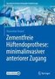 Zementfreie Hüftendoprothese: minimalinvasiver anteriorer Zugang