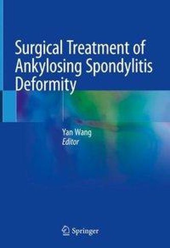 Surgical Treatment of Ankylosing Spondylitis Deformity