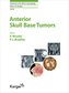 Anterior Skull Base Tumors