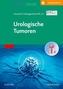 Urologische Tumoren