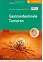 Gastrointestinale Tumoren