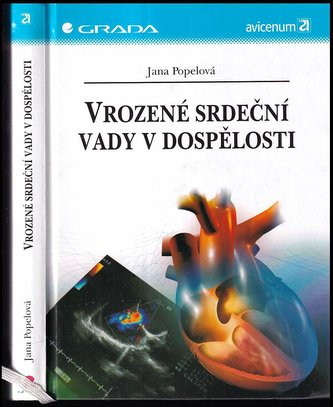 Vrozené srdeční vady v dospělosti